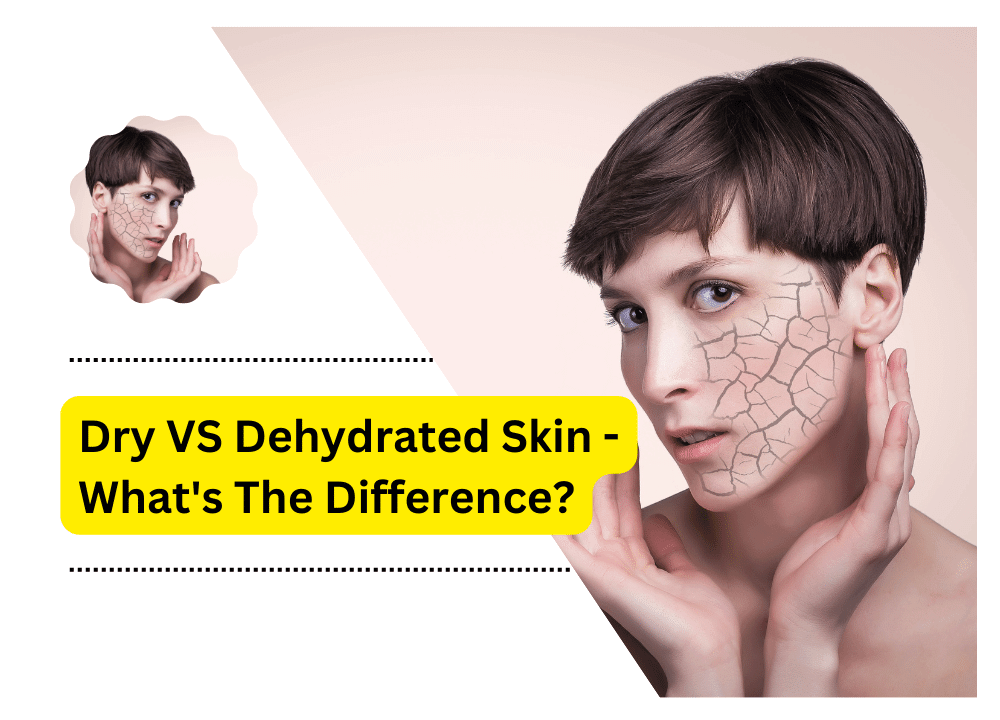 Dry Vs Dehydrated Skin Whats The Difference 9451