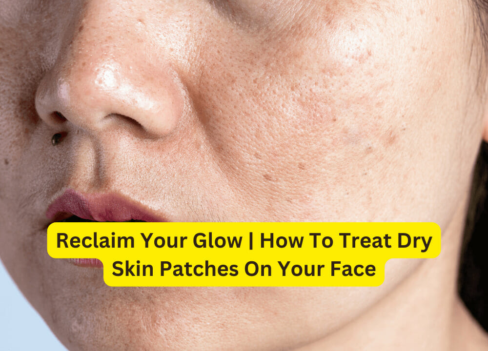 reclaim-your-glow-how-to-treat-dry-skin-patches-on-your-face