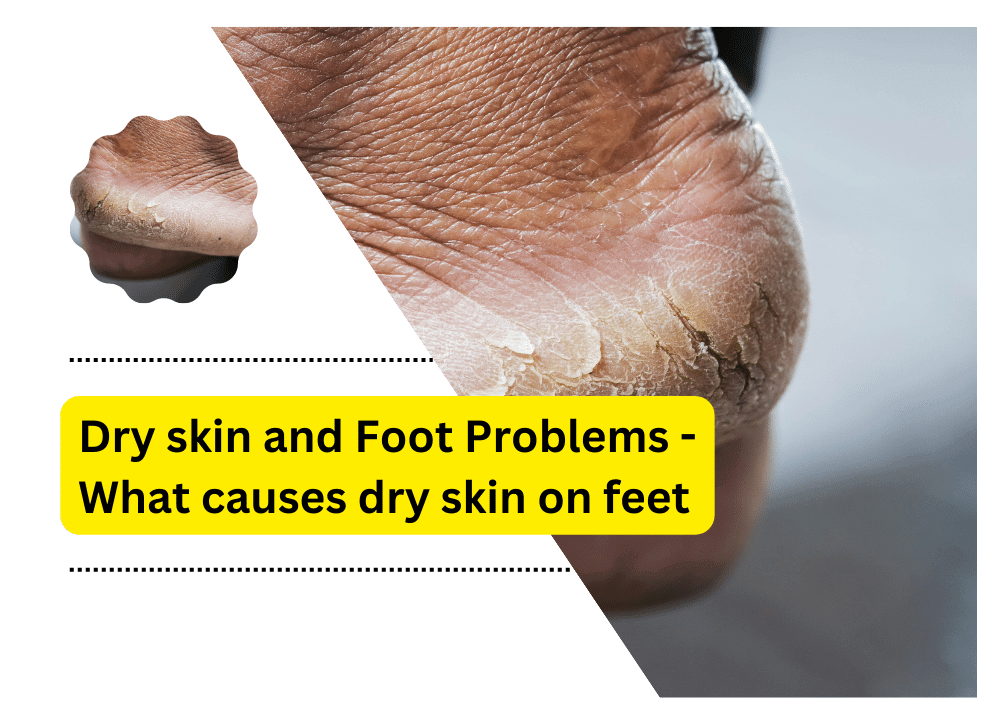 dry-skin-and-foot-problems-what-causes-dry-skin-on-feet