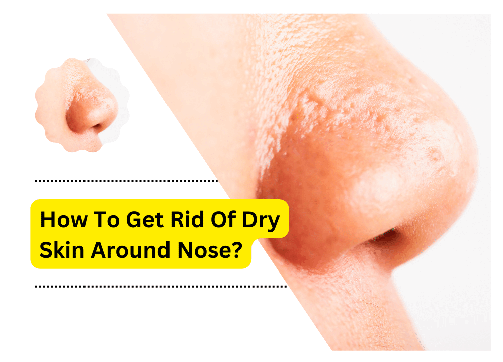 How To Get Rid Of Dry Skin Around Nose 