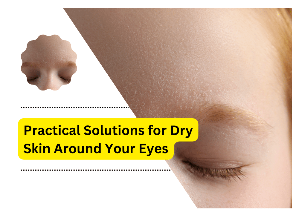 Practical Solutions For Dry Skin Around Your Eyes 4342