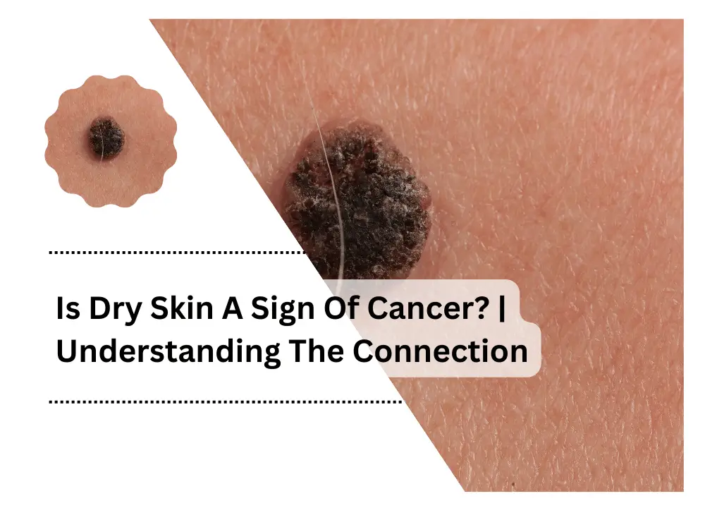 is-dry-skin-a-sign-of-cancer-understanding-the-connection